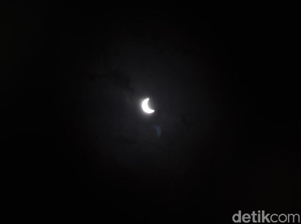 Mata Buram Usai Lihat Gerhana Matahari Cincin? Waspada Solar Retinopathy Mata Buram Usai Lihat Gerhana Matahari Cincin? Waspada Solar Retinopathy