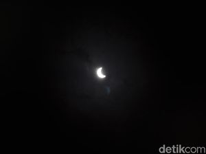 Mata Buram Usai Lihat Gerhana Matahari Cincin? Waspada Solar Retinopathy Mata Buram Usai Lihat Gerhana Matahari Cincin? Waspada Solar Retinopathy
