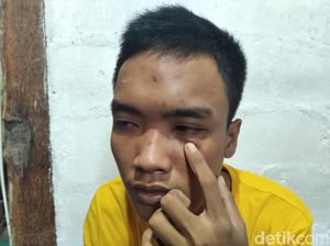 Ngaku Jadi Korban Salah Tangkap, Mahasiswa di Yogya Lapor ke Polda Ngaku Jadi Korban Salah Tangkap, Mahasiswa di Yogya Lapor ke Polda