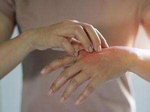 Air Banjir Bisa Picu Infeksi Kulit, Atasi dengan 5 Makanan Ini