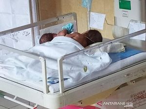 Ibu di Kalteng Lahirkan Bayi Kembar Siam Dempet Dada dan Perut