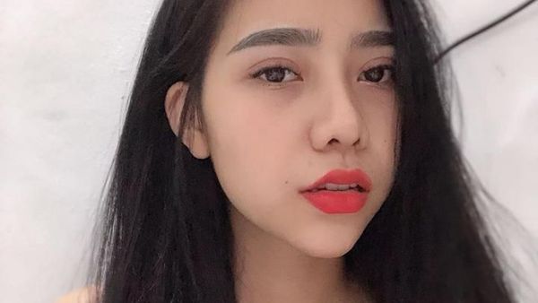 Potret Wanita Operasi Plastik Jadi Cantik Sampai Tak Dikenali Keluarga