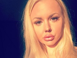 Wanita Alami Payudara Bocor Setelah Operasi, Padahal Sudah Bayar Rp 92 Juta