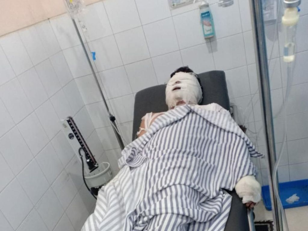 Alami Luka Parah, Korban Rampok-Bakar di Karawang Dirujuk ke RSHS Bandung Alami Luka Parah, Korban Rampok-Bakar di Karawang Dirujuk ke RSHS Bandung
