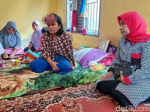 Sri Rahayu Pengidap Kanker Kini Dirujuk ke RS Sadikin