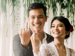 Vanessa Angel Diminta Tak Berbuat Buruk, Begini Respons Bibi