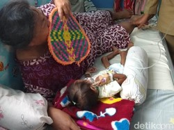 Alami Gizi Buruk Kronis, Tim Dokter Gelontor Asupan Gizi Balita Meilani Alfira
