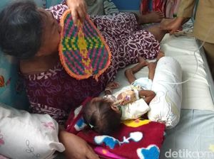 Alami Gizi Buruk Kronis, Tim Dokter Gelontor Asupan Gizi Balita Meilani Alfira Alami Gizi Buruk Kronis, Tim Dokter Gelontor Asupan Gizi Balita Meilani Alfira