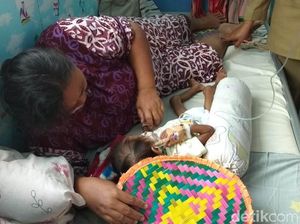 Meilani Alfira Balita Usia 2,8 Tahun Penderita Gizi Buruk Tubuhnya Sangat Kurus Meilani Alfira Balita Usia 2,8 Tahun Penderita Gizi Buruk Tubuhnya Sangat Kurus
