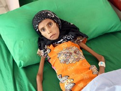 Tak Punya Uang dan Kelaparan, Nasib Orang-orang Ini Berakhir Miris