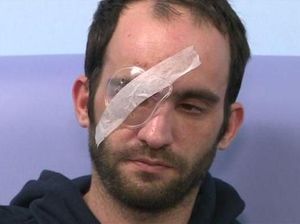 Dilempar Telur, Pemotor Matanya Buta Sebelah