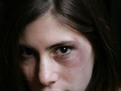 Bikin Tutorial Makeup Tutupi Tanda KDRT, Artis TikTok Jadi Kontroversi