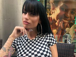 Potret Wanita Habiskan Rp 320 Juta untuk 4 Kali Operasi Pembesaran Payudara