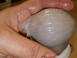 Nyeri sendi hilang! Lutut seperti remaja 18 tahun! Baca