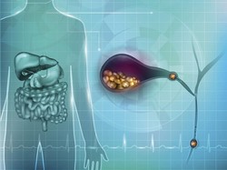 7 Makanan Penghancur Batu Empedu yang Aman Dikonsumsi