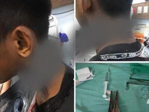 Tertusuk Ikan Hingga Tewas, 5 Kejadian Tragis saat Memancing Ikan