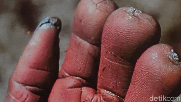 Foto: Tradisi Bakar Jenazah dan Potong Jari Papua