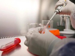 Usai Penerbangan Guangzhou-Manado, Seorang Penerjemah Diisolasi ke RS