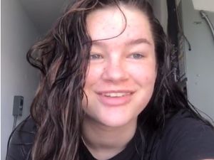 Remaja Berambut Lepek Populer Karena Tak Keramas Selama 8 Tahun