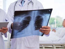 Waspada Pneumonia, Kemenkes Minta Semua Jajaran Kesehatan Siaga