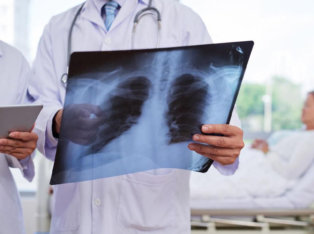 Kazakhstan Bantah China Soal Pneumonia yang Lebih Mematikan dari Corona Kazakhstan Bantah China Soal Pneumonia yang Lebih Mematikan dari Corona