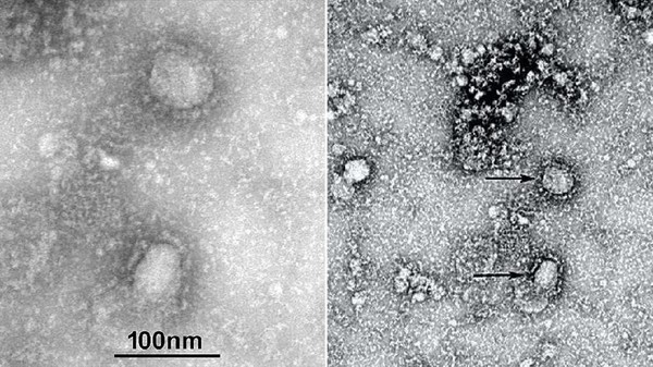 Potret virus corona baru Potret virus corona baru, 2019-nCoV.