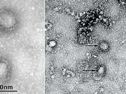 Dokter Corona Meninggal dan Penampakan Virus yang Diisolasi