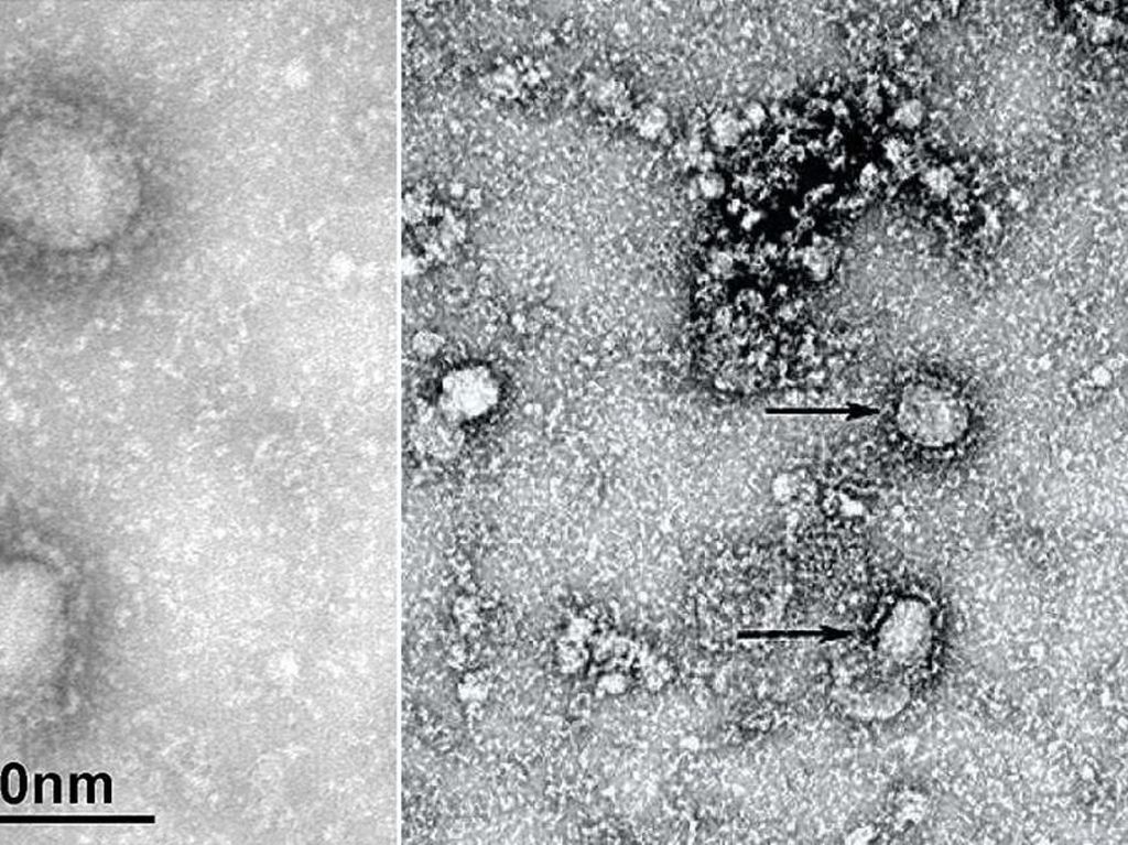 Ini Dia Penampakan Virus Corona Baru yang Mewabah di China Ini Dia Penampakan Virus Corona Baru yang Mewabah di China