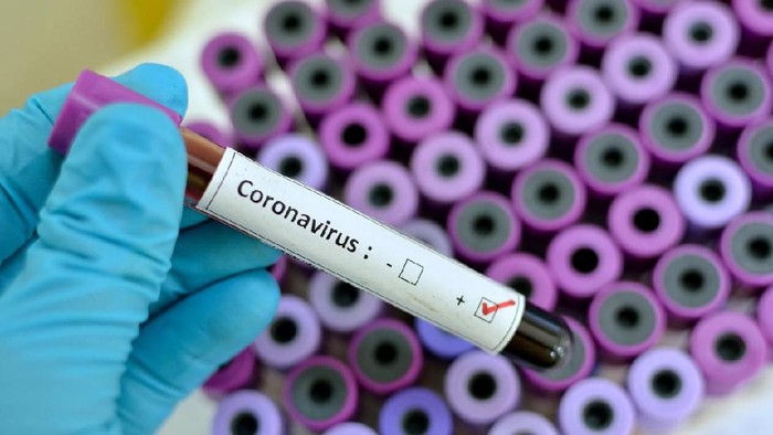 Pencegahan virus corona saat ini jadi cara paling baik menghadapi wabah.  (Foto: iStock)