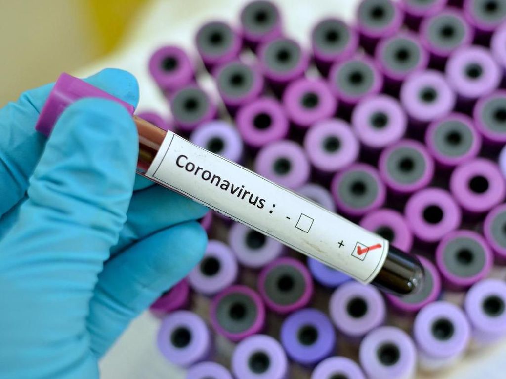 Mengenali Gejala Virus Corona yang Telah Renggut Nyawa 132 Orang