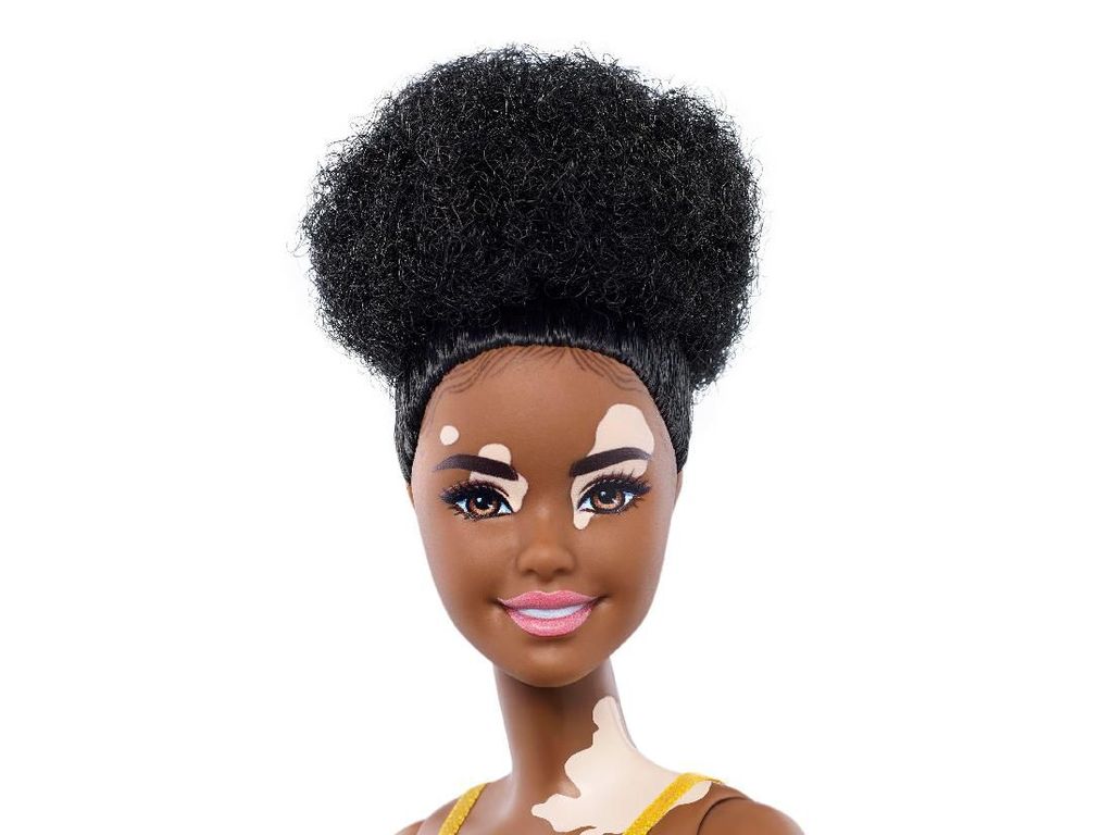 Merayakan Keragaman, Mattel Rilis Barbie Vitiligo hingga Tanpa Kaki