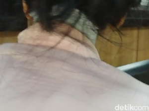 Penyerang Wanita di JPO Olimo Diduga Depresi, Kejiwaannya Akan Dicek Penyerang Wanita di JPO Olimo Diduga Depresi, Kejiwaannya Akan Dicek