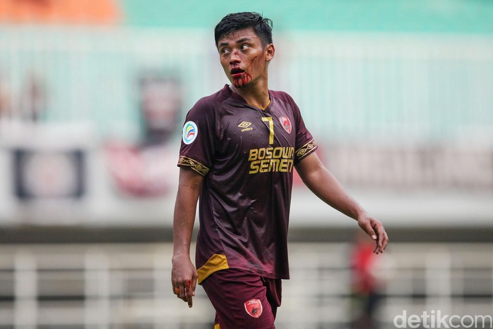 Momen Gol Berdarah Irsyad Maulana Usai mencetak gol, Irsyad Maulana terkapar setelah berbenturan dengan pemain Lalenok United. Hasilnya, Irsyad mengalami patah hidung dan dibawa ambulans.