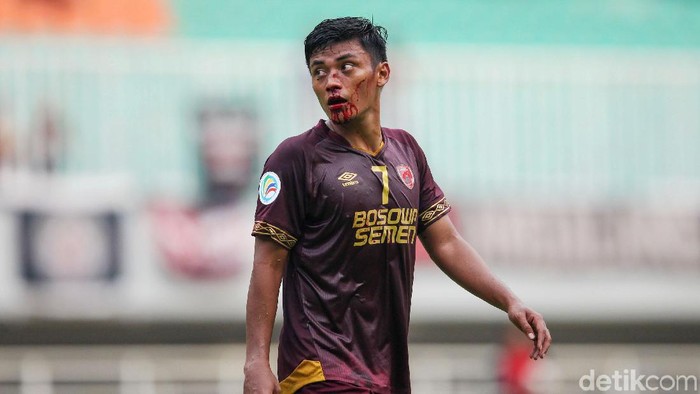 Usai mencetak gol, Irsyad Maulana terkapar setelah berbenturan dengan pemain Lalenok United. Hasilnya, Irsyad mengalami patah hidung dan dibawa ambulans.