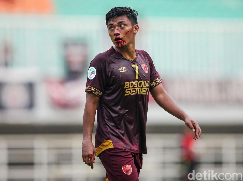 Usai mencetak gol, Irsyad Maulana terkapar setelah berbenturan dengan pemain Lalenok United. Hasilnya, Irsyad mengalami patah hidung dan dibawa ambulans.