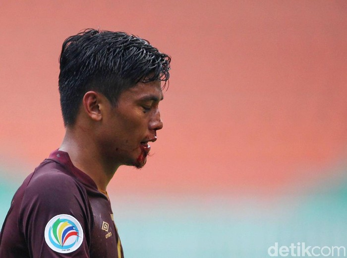 Usai mencetak gol, Irsyad Maulana terkapar setelah berbenturan dengan pemain Lalenok United. Hasilnya, Irsyad mengalami patah hidung dan dibawa ambulans.