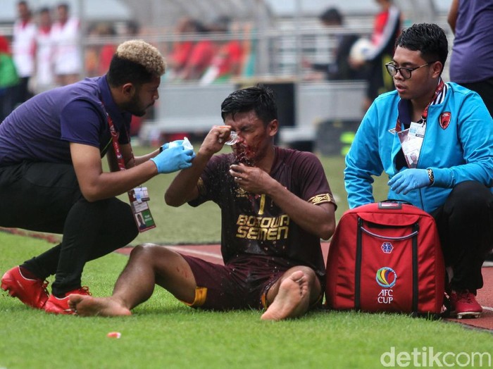 Usai mencetak gol, Irsyad Maulana terkapar setelah berbenturan dengan pemain Lalenok United. Hasilnya, Irsyad mengalami patah hidung dan dibawa ambulans.