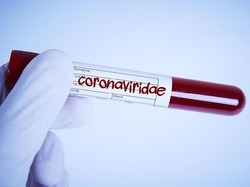 Banyak yang Meninggal, Bagaimana Pasien Virus Corona di China Bisa Sembuh?