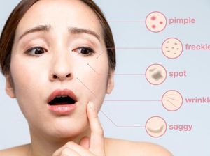 Minum Pakai Sedotan Percepat Penuaan Dini? Ini Kata Spesialis Kulit Minum Pakai Sedotan Percepat Penuaan Dini? Ini Kata Spesialis Kulit