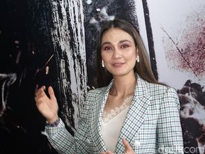 Luna Maya Alami Patah Tulang Metatarsal, Ini Penyebabnya