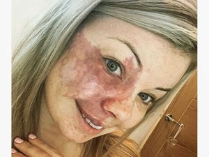 Potret Wanita dengan Tanda Lahir di Wajah, Kini PD Tampil Tanpa Makeup