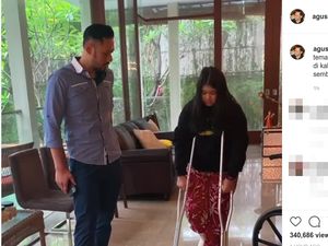 Alami Fraktur di Kaki Kanan, Cucu SBY Belajar Jalan Pakai Tongkat Alami Fraktur di Kaki Kanan, Cucu SBY Belajar Jalan Pakai Tongkat