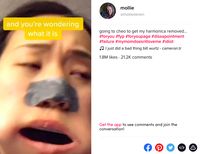 Kasihan, Mulut Cewek Ini Tersangkut Harmonika Gegara TikTok