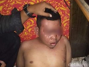 Anak di Gresik yang Dibawa Kabur Saat Beli Jajan Alami Trauma