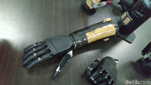 Tangan Bionik Canggih Buatan Undip Semarang