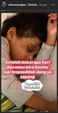 Shireen Sungkar Hampir Pingsan Lihat Mata Anak Lebam Jatuh Terbentur