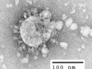 Kenapa Virus Corona Bermutasi? Ini Faktor yang Menentukan