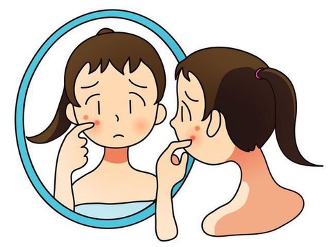 Tips Mencuci Wajah Saat Berjerawat