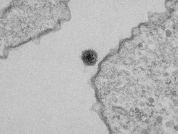 Viral! Peneliti Brazil Temukan Virus Misterius yang Tak Dikenali Asal Usulnya