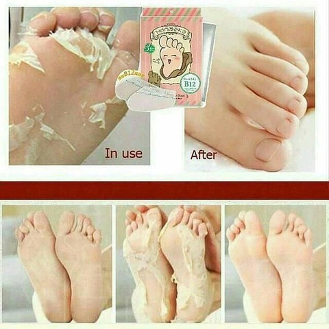 Rahasia Tumit Dan Telapak Kaki Halus Selembut Kulit Bayi Rahasia Tumit Dan Telapak Kaki Halus Selembut Kulit Bayi